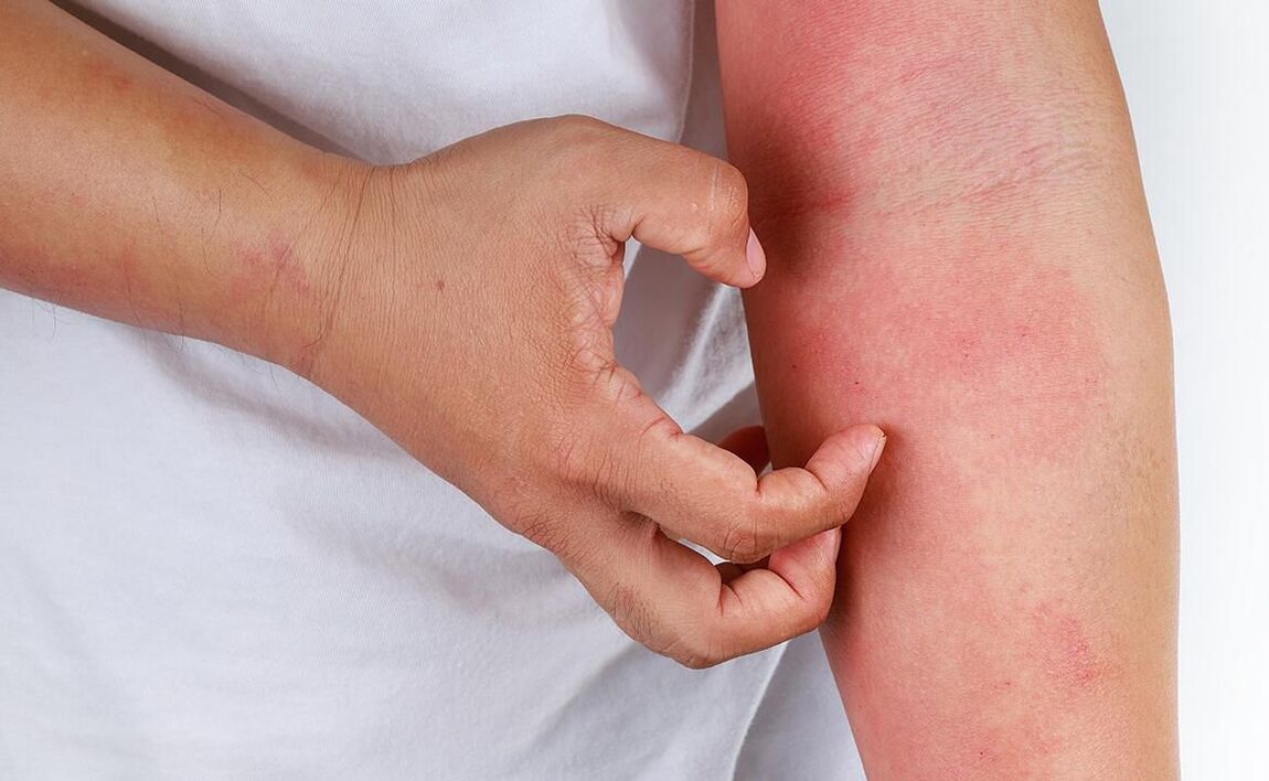 możliwe powikłania po użyciu sody